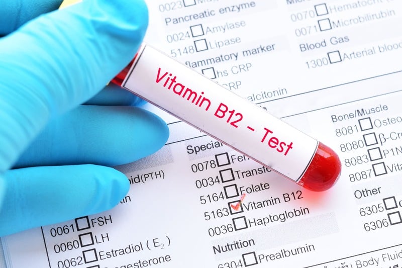 vitamina b12 test