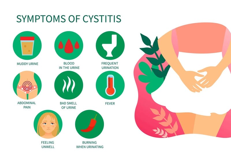 cistite sintomi